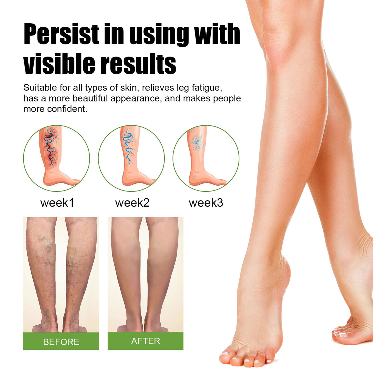 Venolight™ Vein Support Spray | Visibly smoother legs in just 14 days!